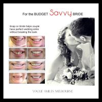 Wedding Bridal Smile Makeover SPECIALS & PACKAGES image 2